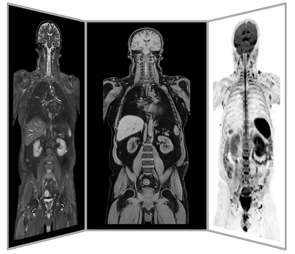 MR Oncology-1